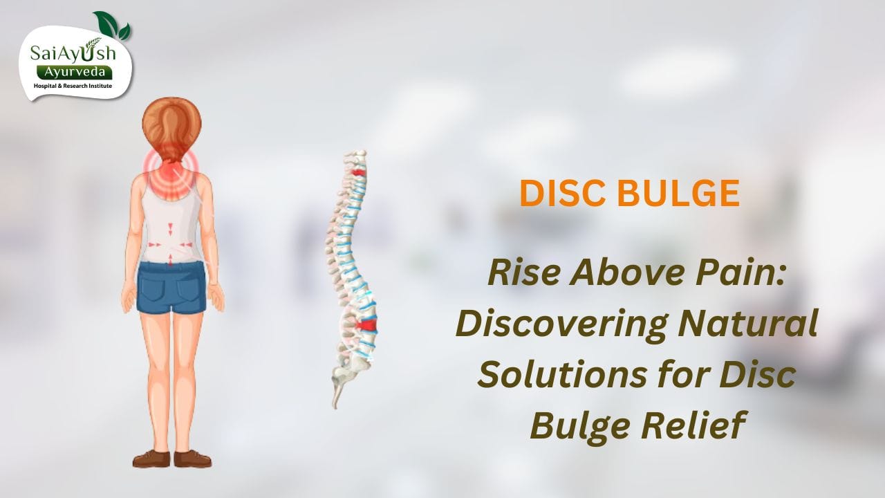 Disc bulge Disc bulge