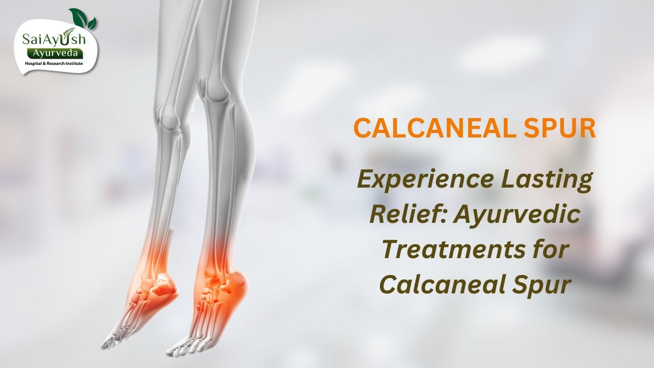 Calcaneal spur Calcaneal spur