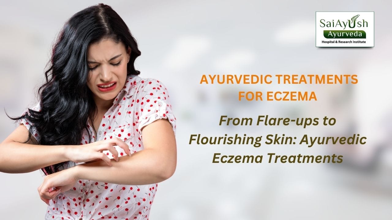 Ayurvedic treatments for eczema Ayurvedic treatments for eczema