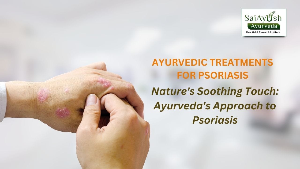 Ayurvedic treatments for psoriasis