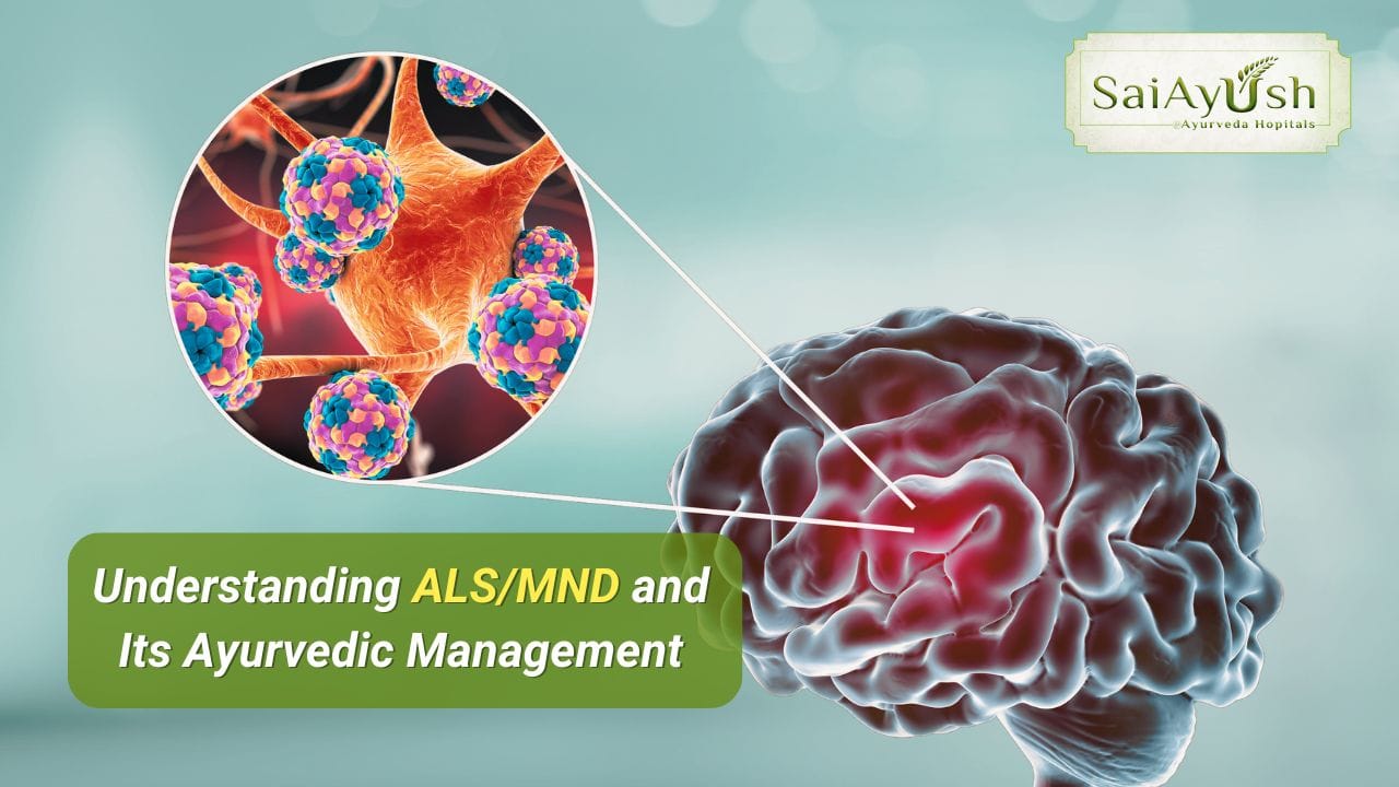 Understanding ALS MND and Its Ayurvedic Management SaiAyush
