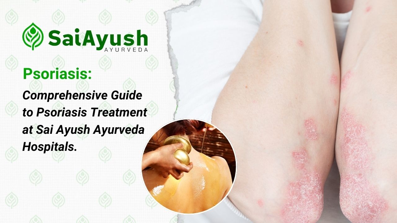 Psoriasis Treatment at Sai Ayush Ayurveda 1 Psoriasis Treatment at Sai Ayush Ayurveda 1